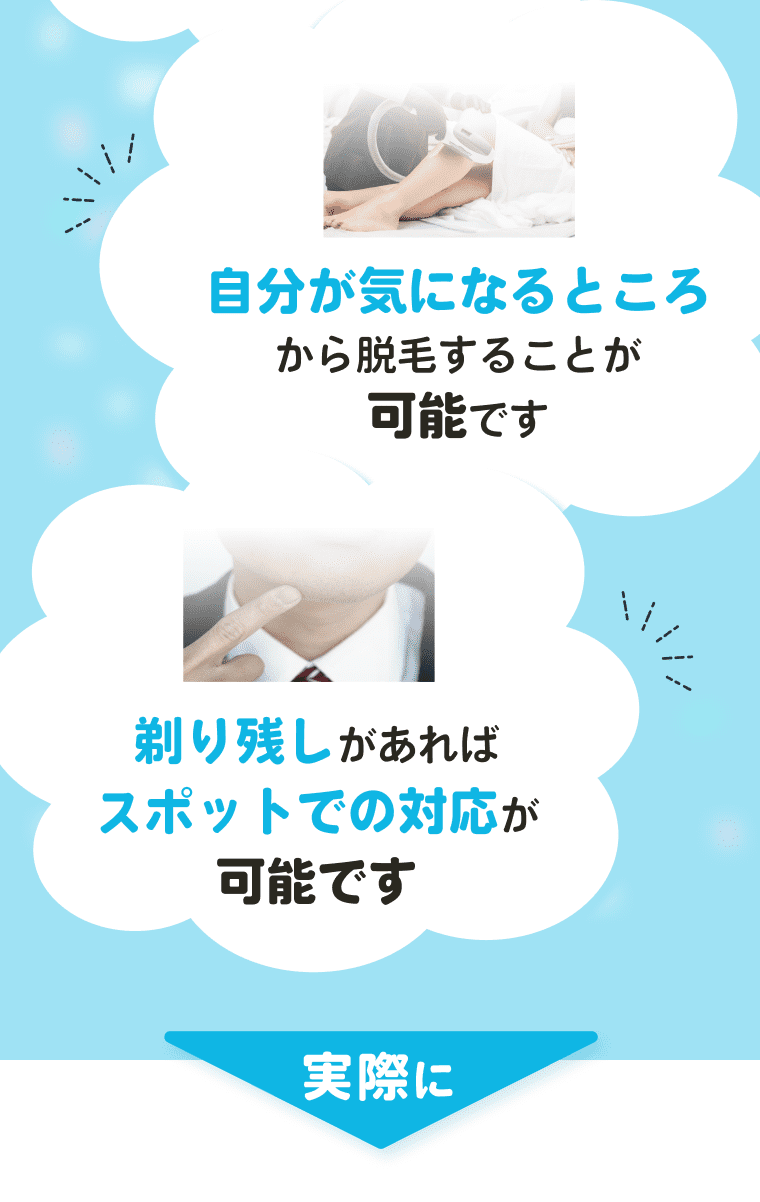 脱毛
